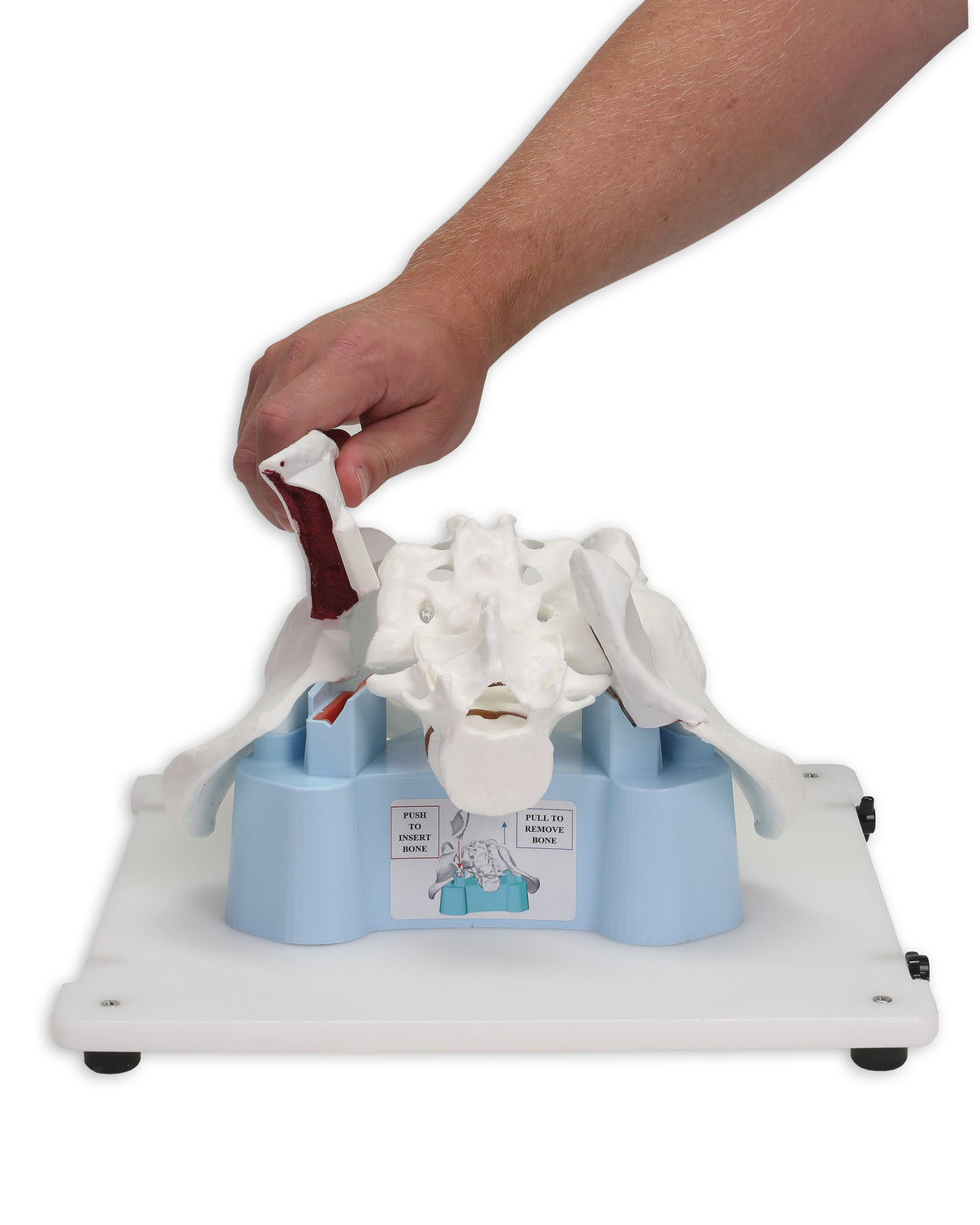 Bonnie Bone Marrow Biopsy™ Skills Trainer With Case & 5-Pack Of Illiac Crest Inserts