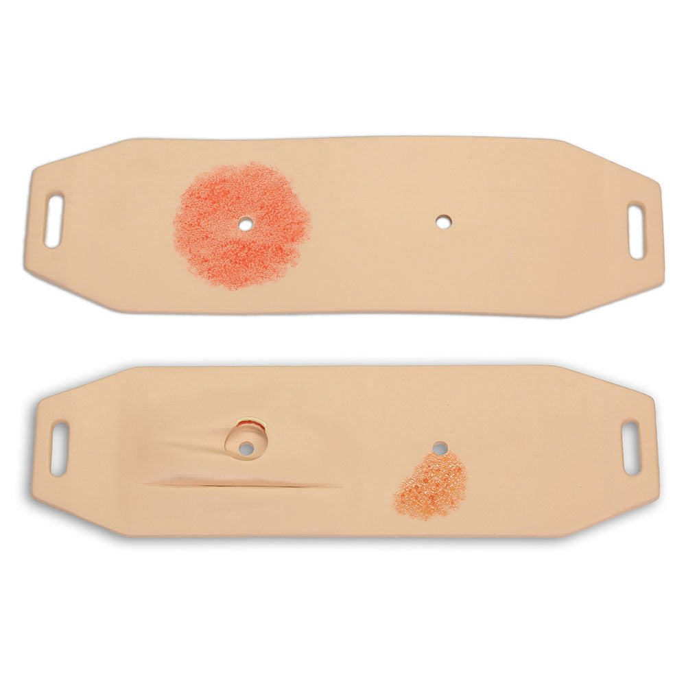 Ostomy Pouching Trainer
