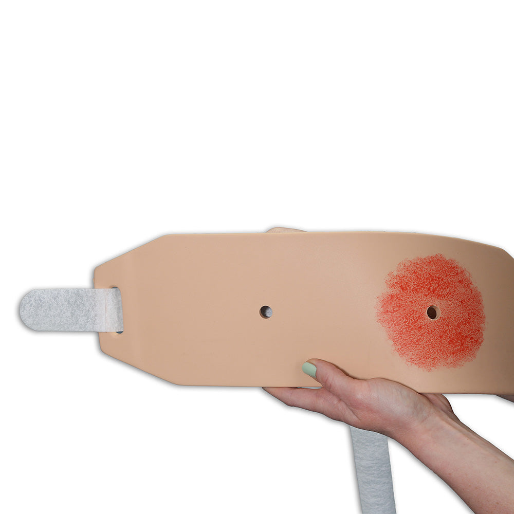 Ostomy Pouching Trainer