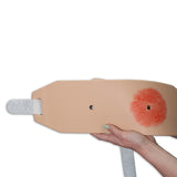 Ostomy Pouching Trainer