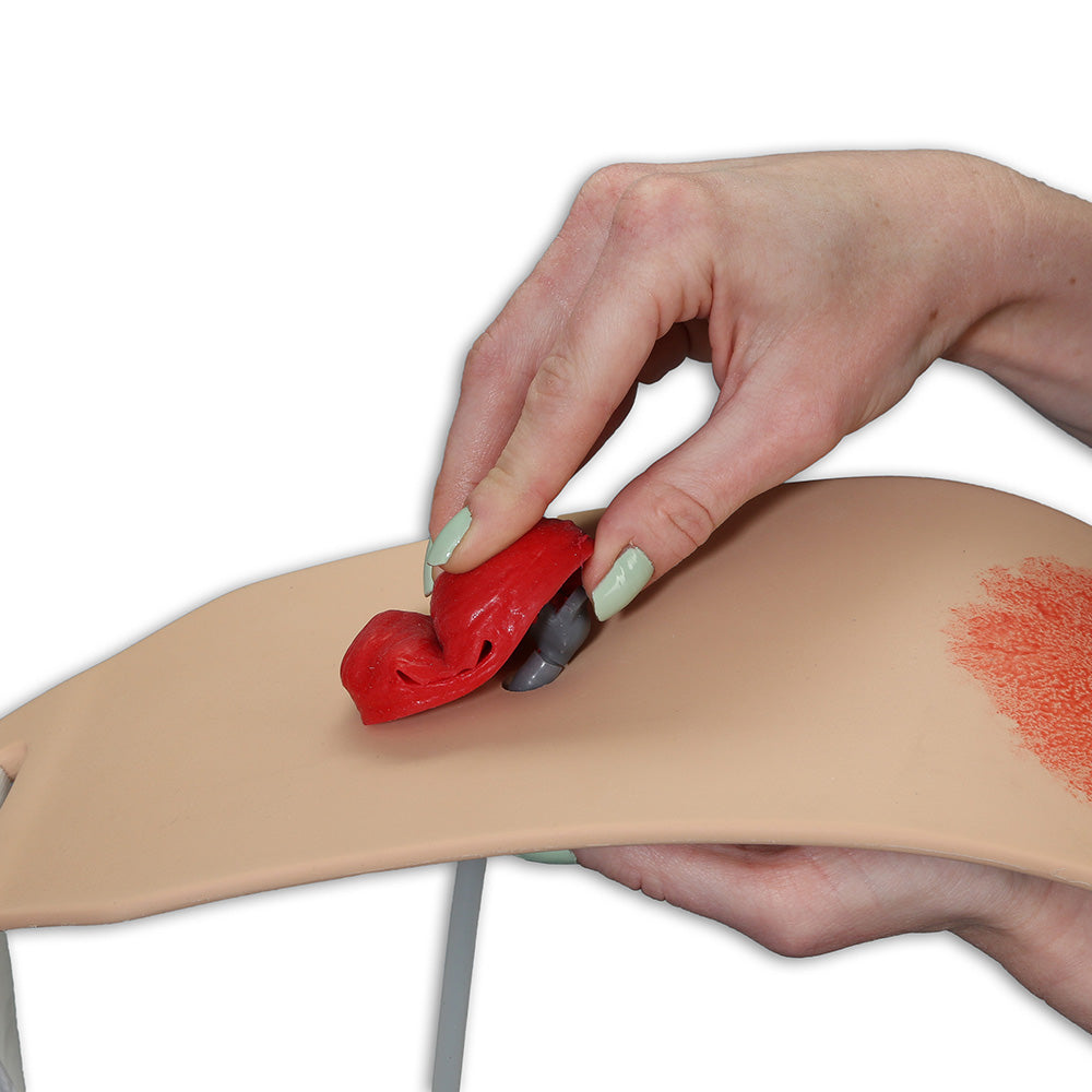 Ostomy Pouching Trainer