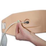 Ostomy Pouching Trainer