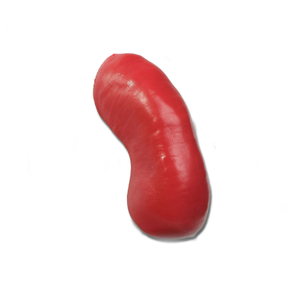 Prolapsed Stoma For Use With Otto Ostomy
