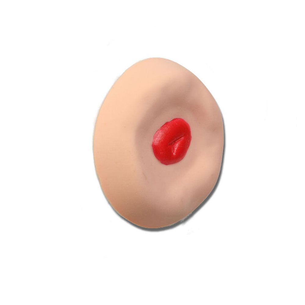Recessed Stoma For Use With Otto Ostomy