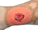 Vinnie Venous Insufficiency Leg Model