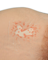 Vinnie Venous Insufficiency Leg Model