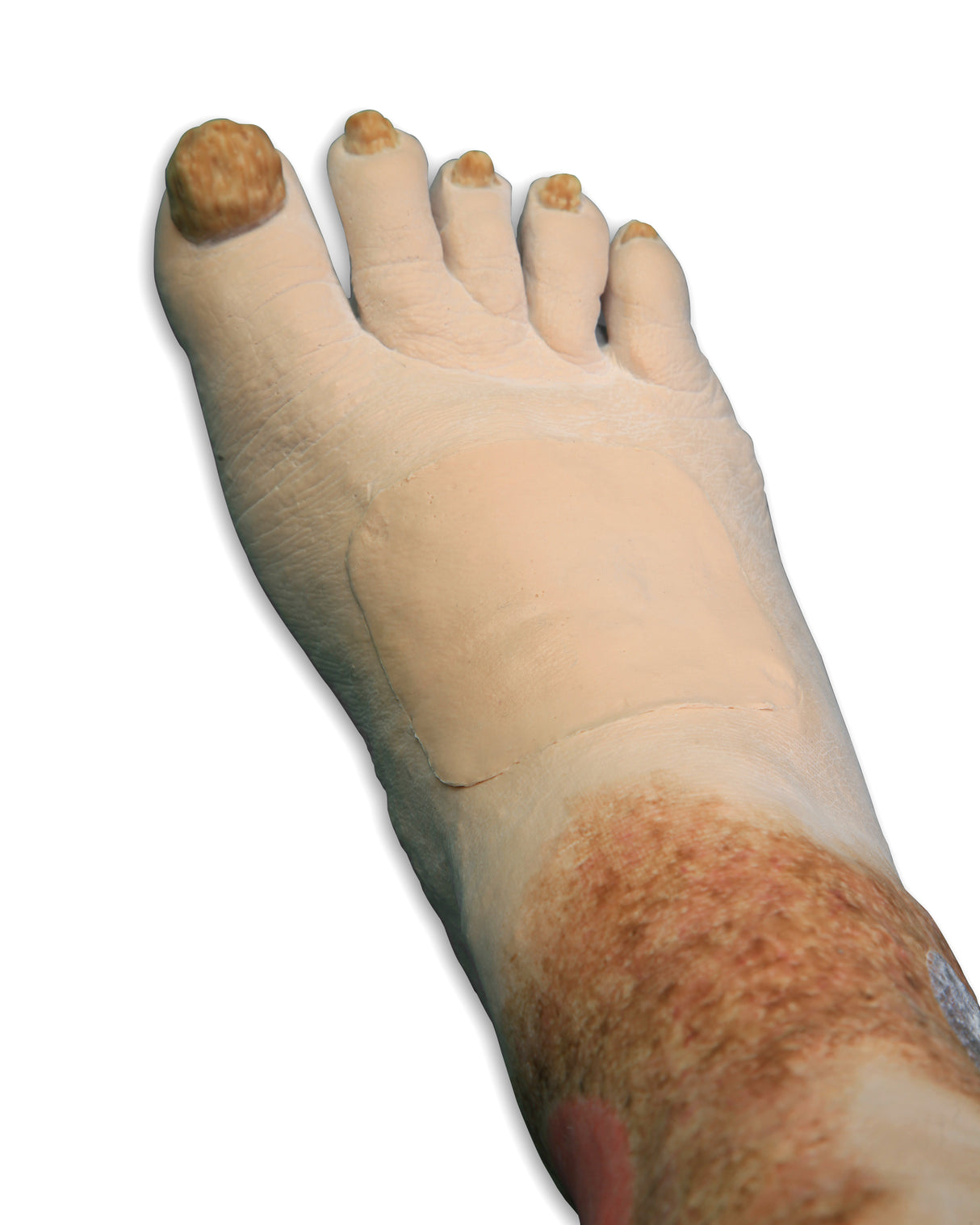 Vinnie Venous Insufficiency Leg Model