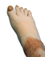 Vinnie Venous Insufficiency Leg Model