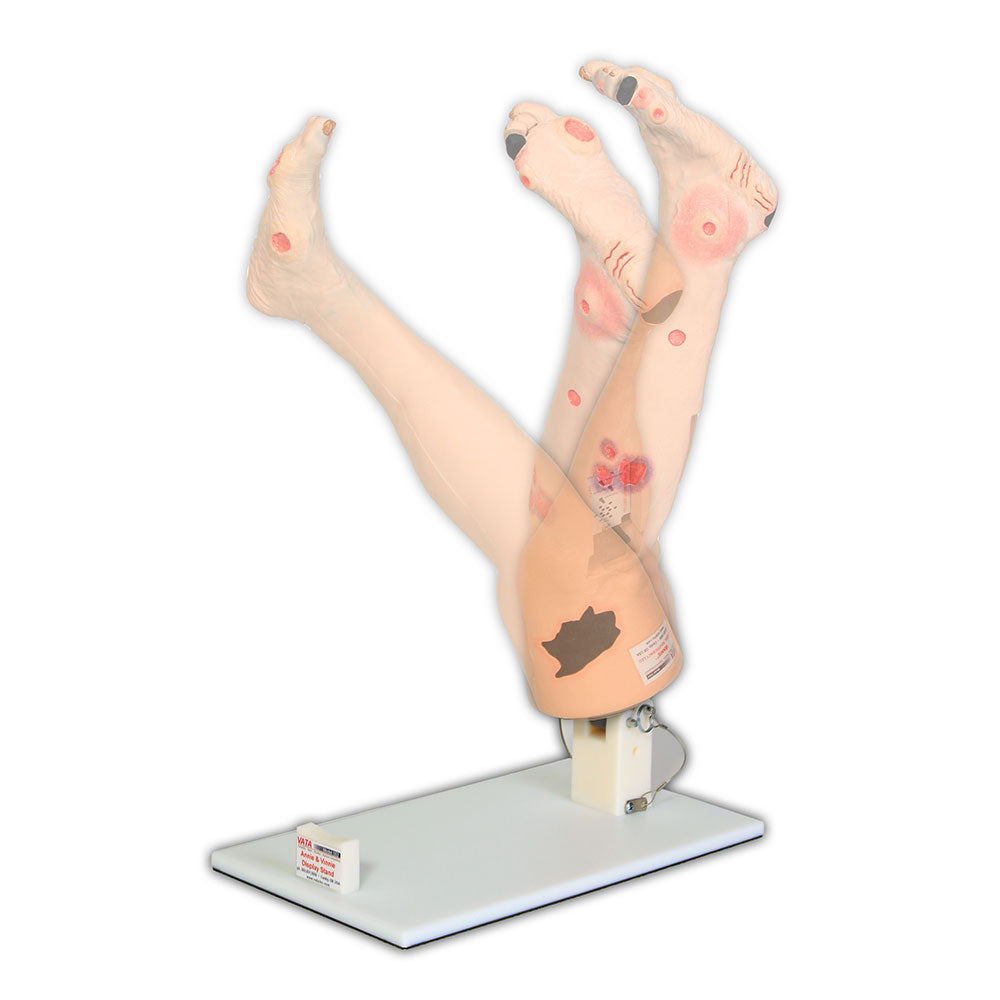 Optional Display Stand For Vinnie Or Annie Insufficiency Leg