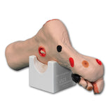 Wilma Wound Foot™