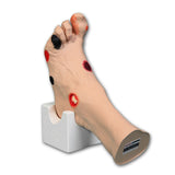 Wilma Wound Foot™