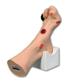 Wilma Wound Foot™