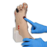 Wilma Wound Foot™