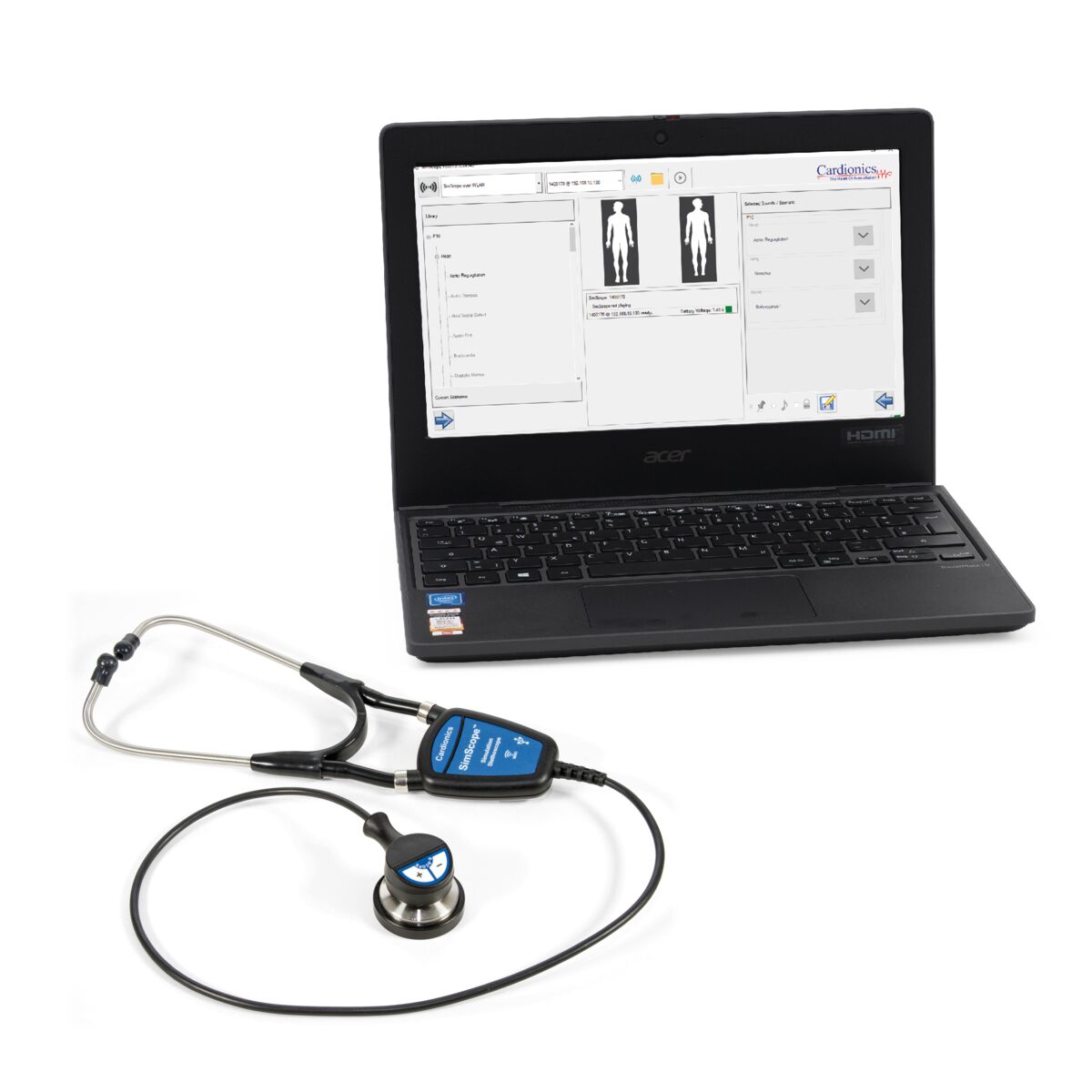 SimScope® Auscultation Training Stethoscope WiFi