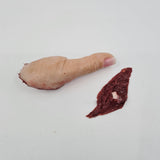 Severed Male Thumb With Wound