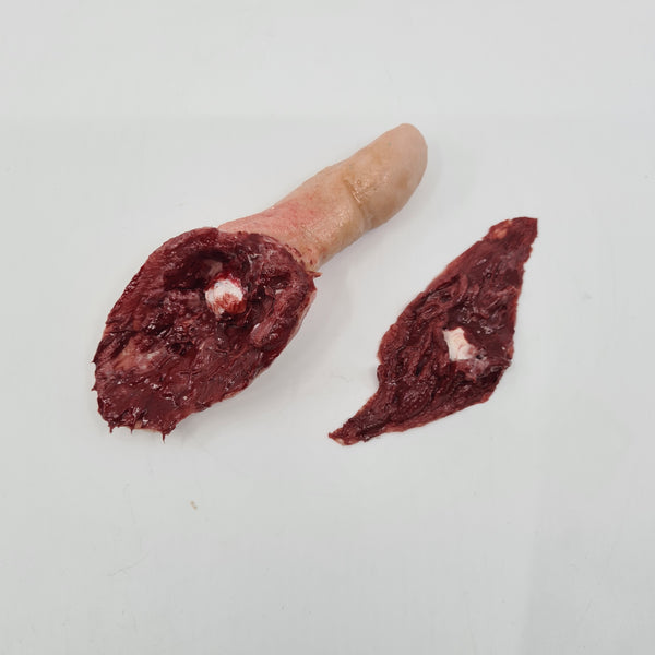 Severed Male Thumb With Wound