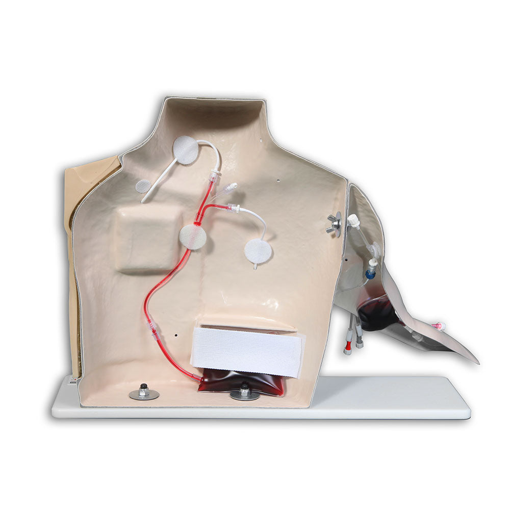 Chester Chest™ With Port Access Arm (Peripheral Arm Port Not Included)