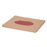 Vata Skin Graft Wound Board
