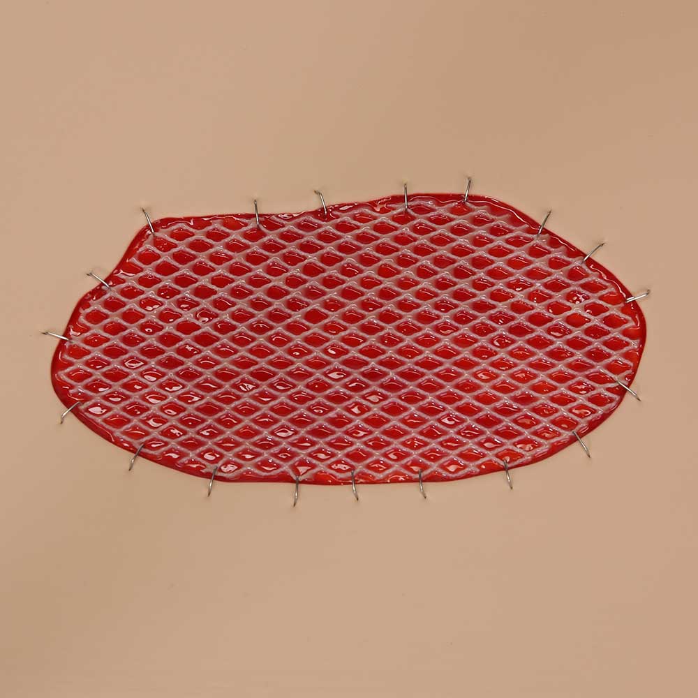 Vata Skin Graft Wound Board