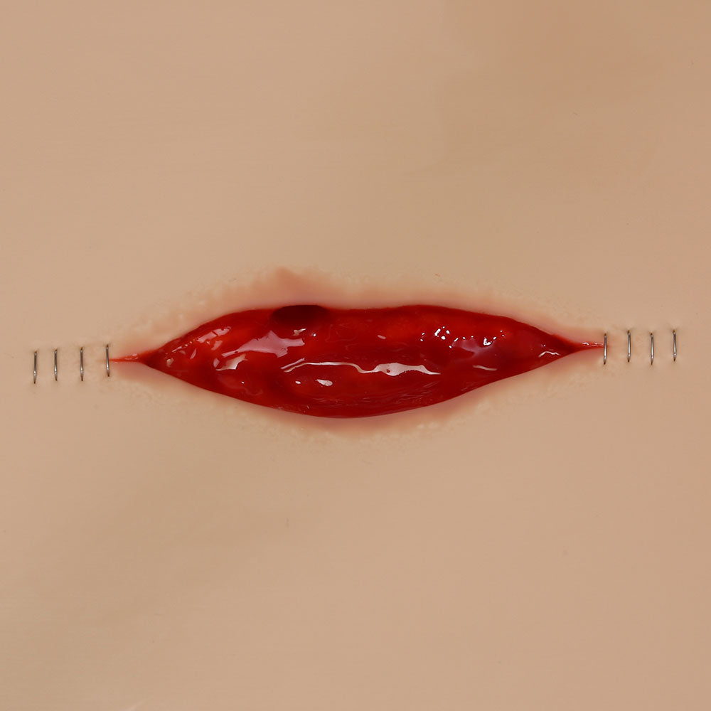 Vata Dehisced Wound Board, Lightly Pigmented