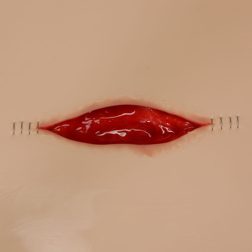 Vata Dehisced Wound Board, Lightly Pigmented