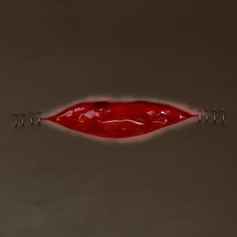 Vata Dehisced Wound Board, Lightly Pigmented