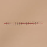 Vata Stapled Incision Wound Board