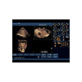 Blue Phantom Transvaginal Ultrasound Training Model