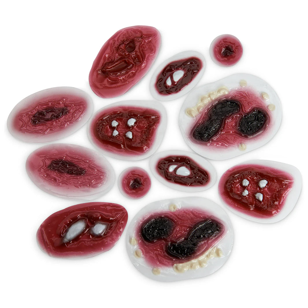 Stick-On Wounds-Dozen Assorted