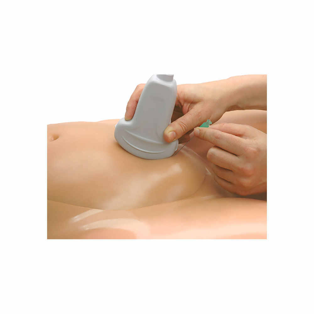 Blue Phantom Amniocentesis Ultrasound Training Model