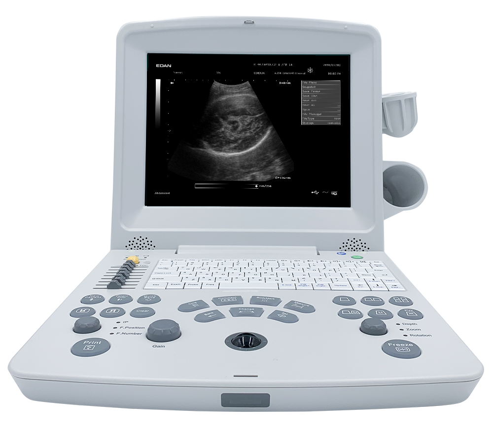 DUS60 Black and White Ultrasound