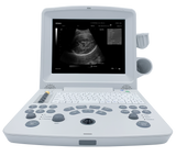 DUS60 Black and White Ultrasound