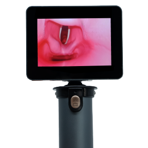 EZ Vision Video Laryngoscope