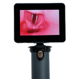 EZ Vision Video Laryngoscope