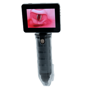 EZ Vision Video Laryngoscope