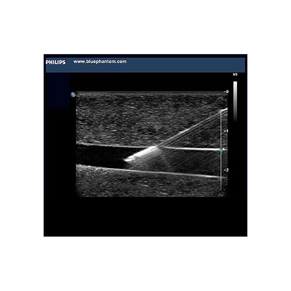 Blue Phantom Paracentesis Ultrasound Training Model