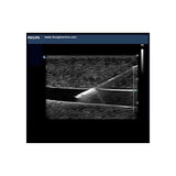 Blue Phantom Paracentesis Ultrasound Training Model