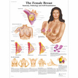 Wearable Breast Self Examination Model