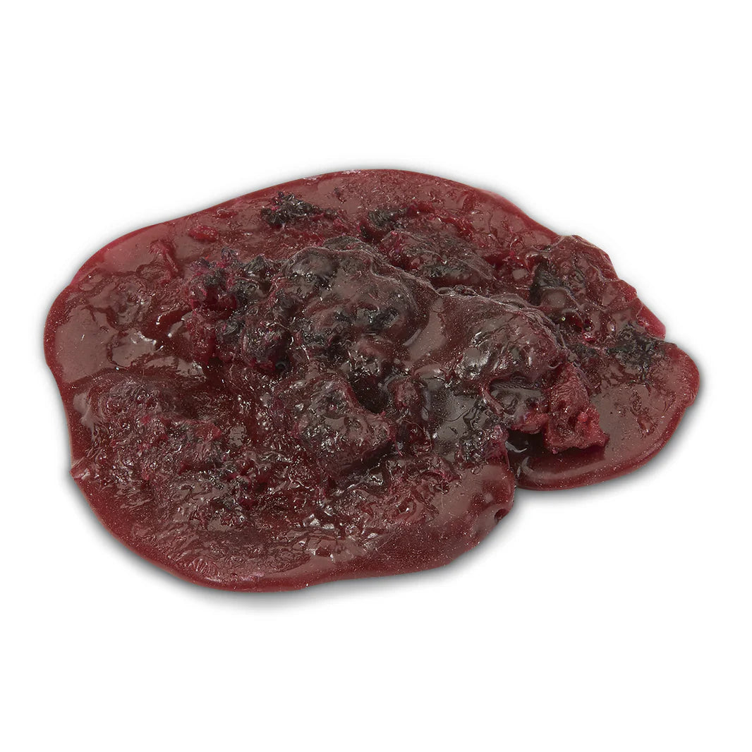 Blood Clot