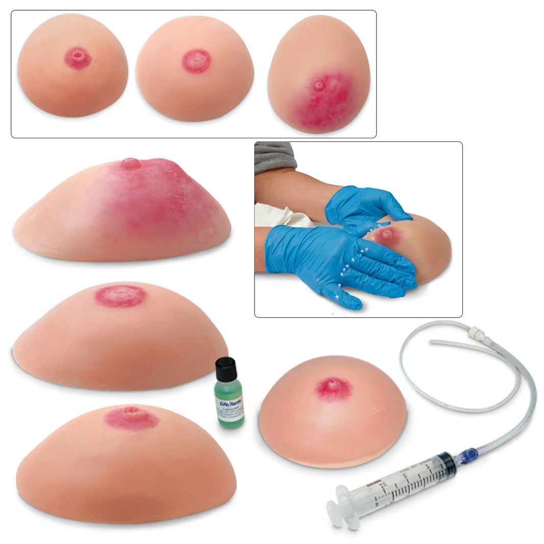 Common Breast Conditions Replicas - Set of 4