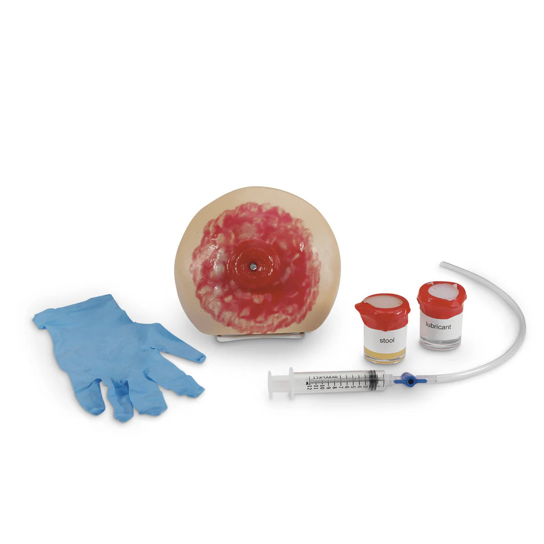 Infected Ostomy Model