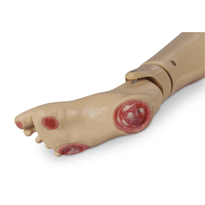 GERi/ KERi Optional Pressure Injury Foot