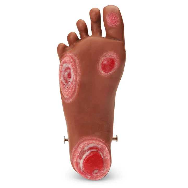 GERi / KERi Optional Pressure Injury Foot