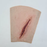 Suture Wrist Laceration