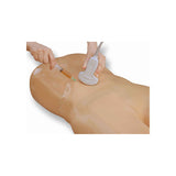 Blue Phantom Paracentesis Ultrasound Training Model