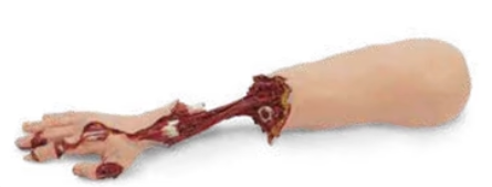 Xtreme Trauma Bleeding Arm