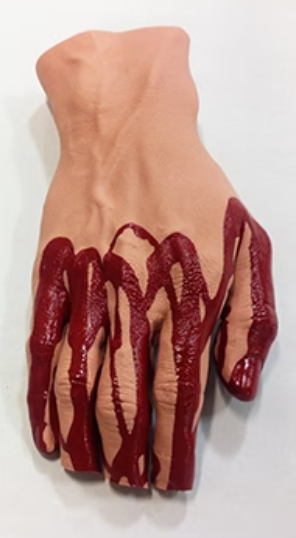 Hand With Severed Fingers