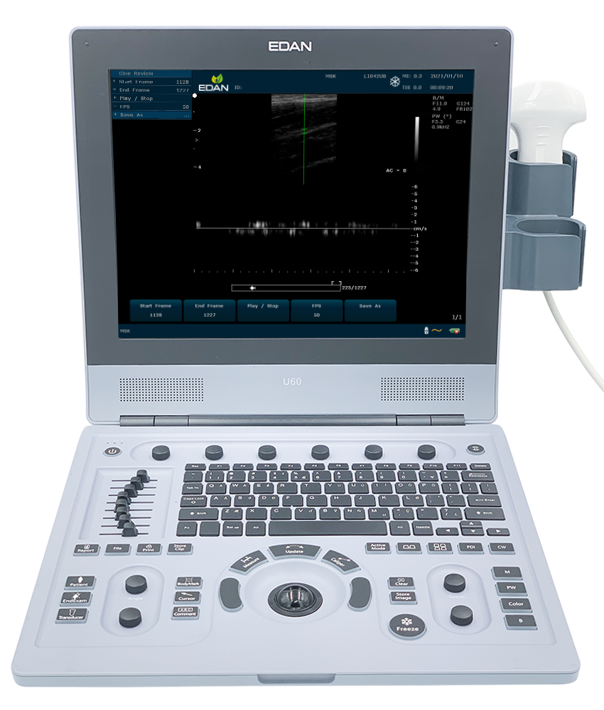 U60 Color Ultrasound