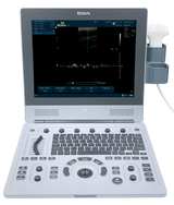 U60 Color Ultrasound