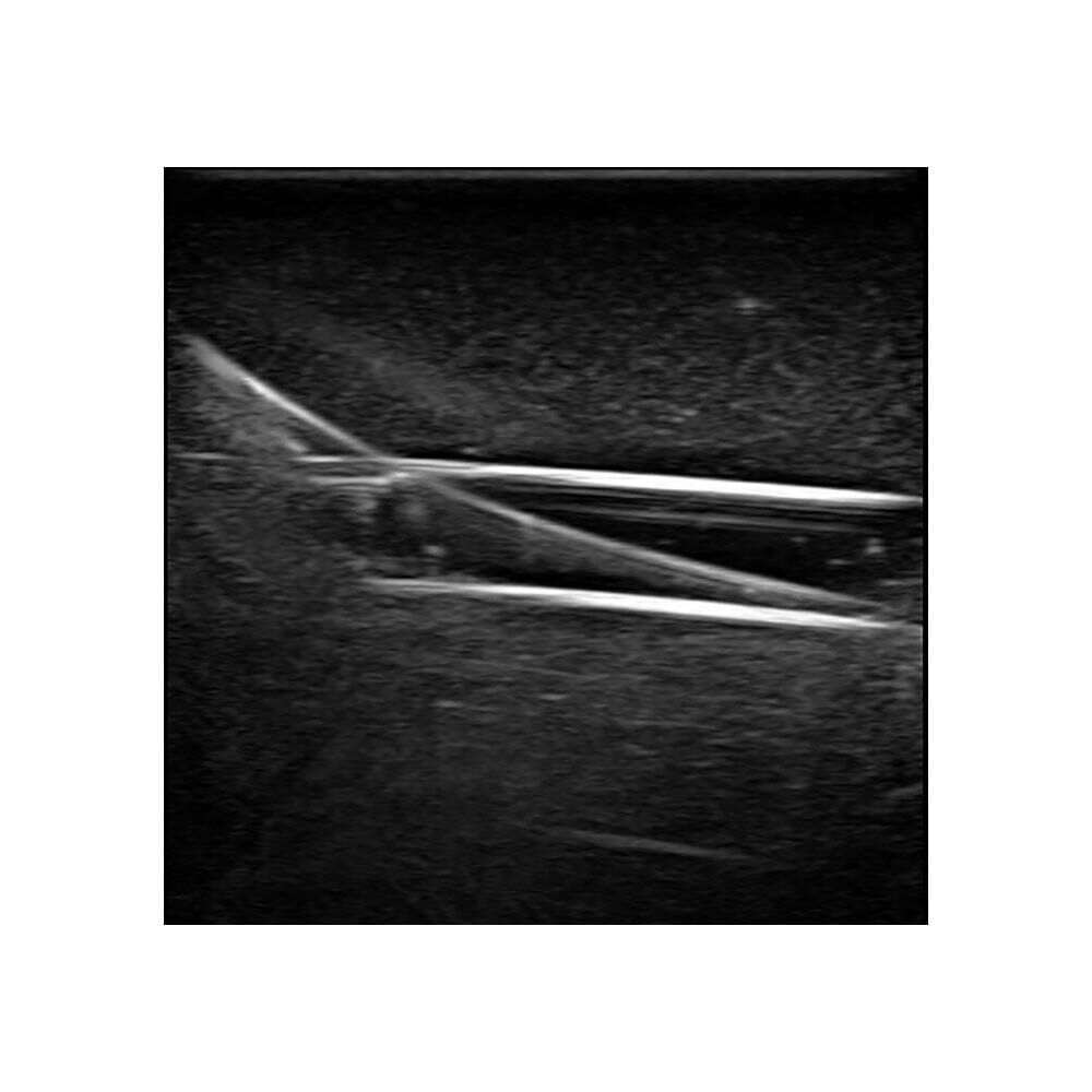 Blue Phantom Gen II PICC, PIV and Arterial Line Vascular Access Ultrasound Training Model